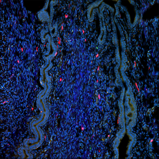 mCherry-expressing dendritic cells (red) in the female genital tract of a CD11c-mCherry transgenic reporter mouse. The animal was intravenously injected with Hoechst 33342 to stain all nucleated cells (blue). The epithelial cells were visualized with an autofluorescence signal (green/turquoise hue).