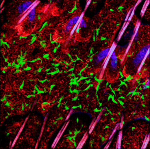 EGFP-expressing dendritic epidermal T cells (green) in the skin of a mouse. Intravenously injected Rhodamin 6G demarcates the dermal-epidermal border (red). Hair shafts (purple) are rooted in hair follicles revealed by their sebaceous glands (blue autofluorescence)
