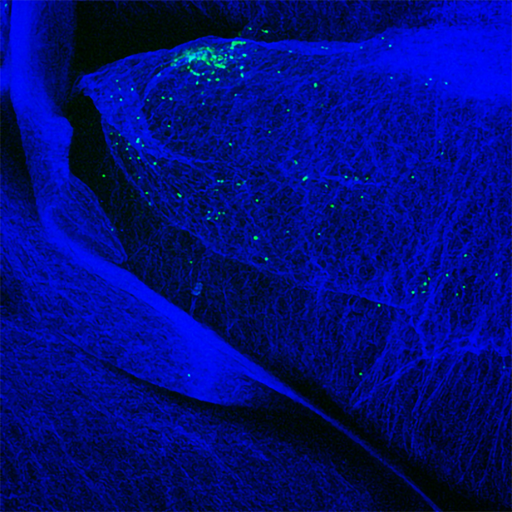 GFP-expressing T cells (green) accumulating around a pancreatic islet in a mouse developing autoimmune pancreatitis, ultimately leading to diabetes