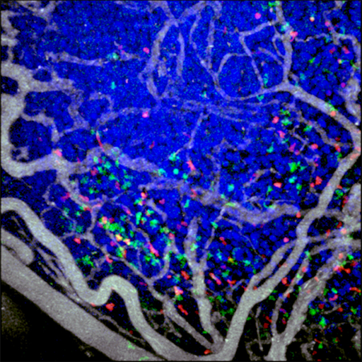 GFP-expressing cytotoxic T lymphocytes (green) and tdTomato-expressing regulatory T cells (red) infiltrating a mouse colon carcinoma implanted into a dorsal skinfold chamber. Tumor cell nuclei (blue) are tagged through expression of a Cerulean-histone H2B fusion protein. Blood vessels (white) are highlighted through intravenous injection of QTracker 655 quantum dots.