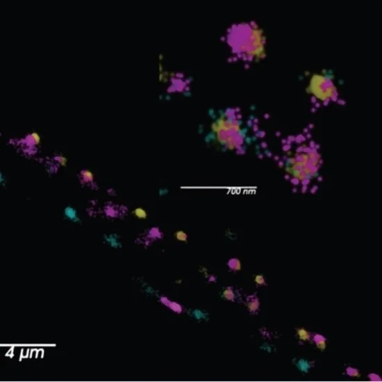 The synaptic labeling of C. elegans. Three markers are present in this image: yellow (Skylan-s Active zone marker), magenta (HaloTag::JF646 Calcium Channel 1), and cyan (SNAPf::JF549 Calcium Channel 2).