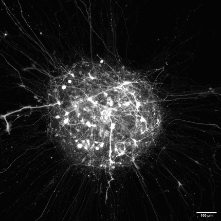 Neural circuits developed in a live spheroid imaged with the Ultima 2Pplus in an inverted configuration