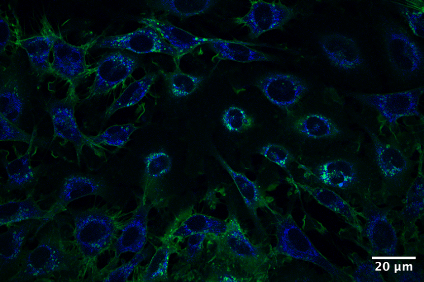 Live melanoma cells expressing membrane-bound GFP. Blue Channel: excitation 740, emission 460/50 (mainly autofluorescence). Green Channel: excitation 860 nm, emission 525/50 (GFP).