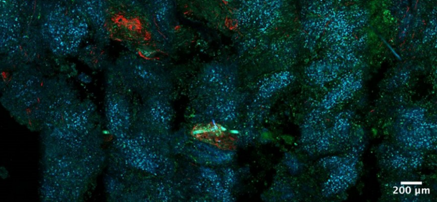 Label-free tile-scan of a fresh melanoma tumor from a mouse model