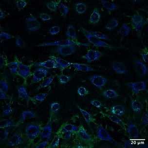 The Inverter Module supports cancer biology workflows.