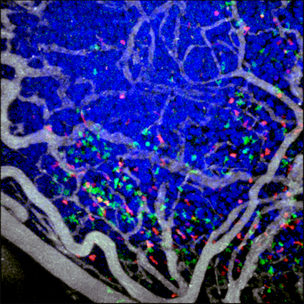 The Inverter Module enables high-resolution imaging in immunology and cell biology workflows.