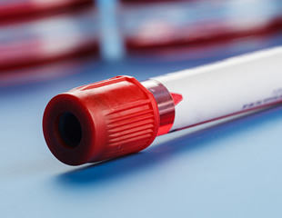 RNAConnect Launches the UltraMarathonRT Direct RNA‑Seq Kit to Advance Nanopore-Based Native RNA Sequencing