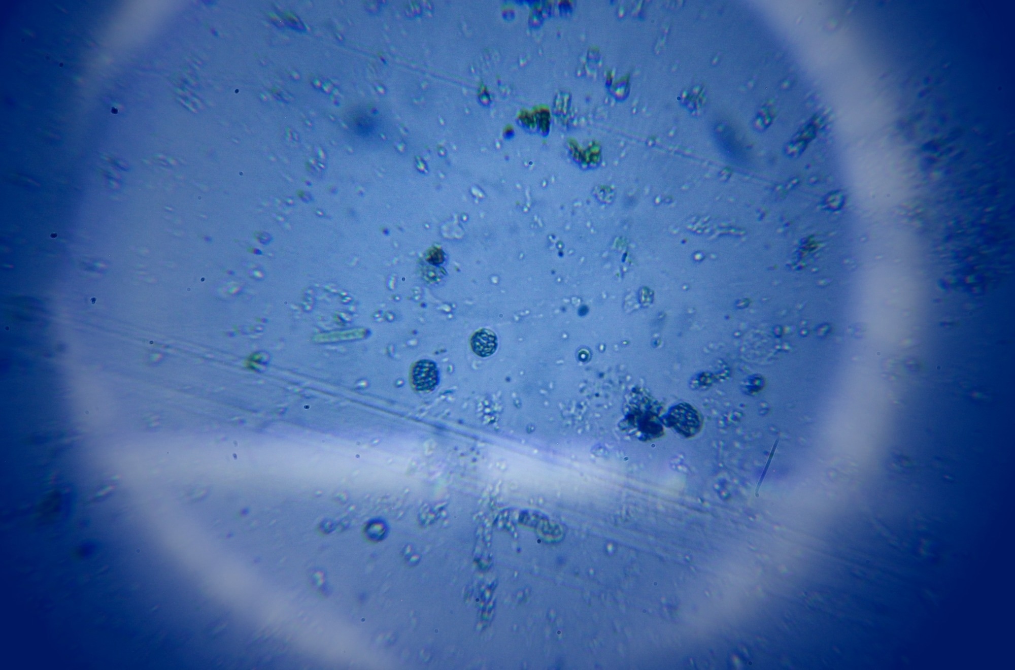 viruses and bacteria under the microscope