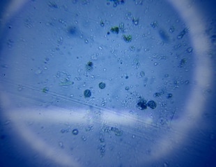 Researchers Discover New Bacterial Species with Reversed Lifecycle Complexity