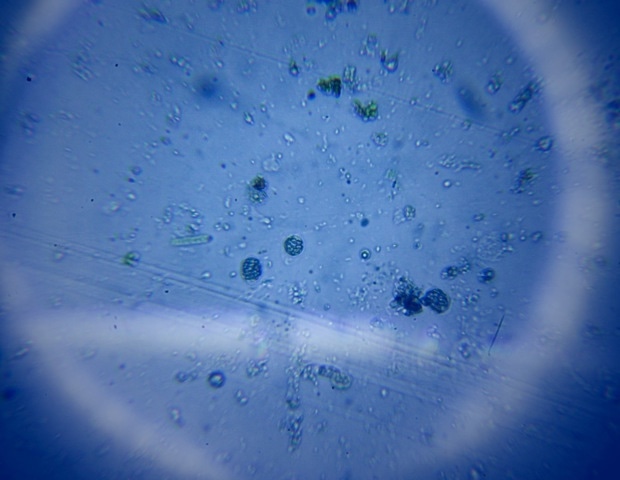 Researchers Discover New Bacterial Species with Reversed Lifecycle Complexity