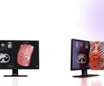 How Avatar Medical's 3D Technology Is Transforming How We Visualize the Human Body