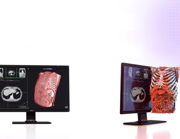 How Avatar Medical's 3D Technology Is Transforming How We Visualize the Human Body