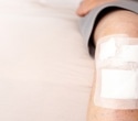 Smart Hydrogel Senses Infected Wounds and Delivers the Right Treatment