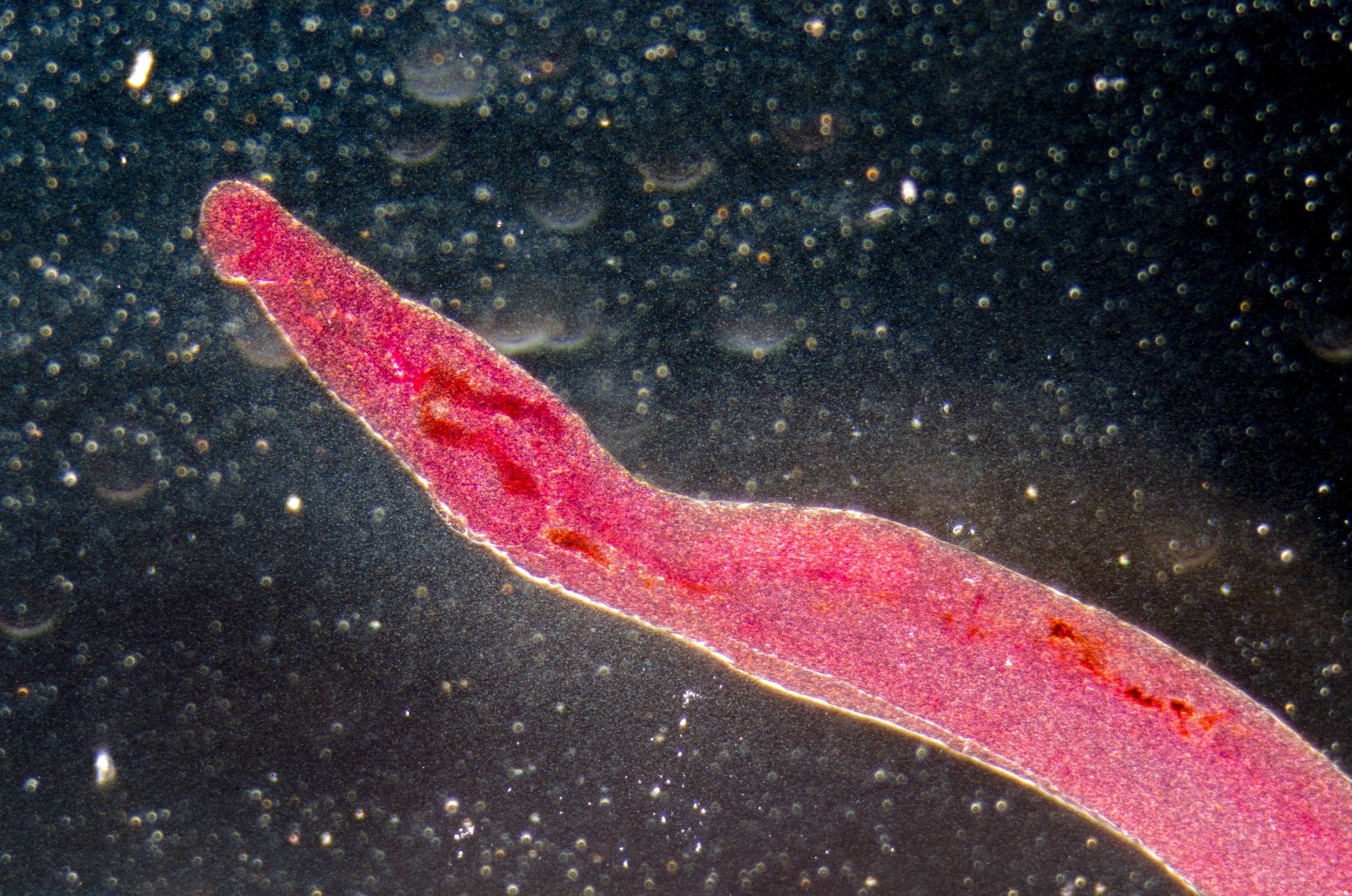 medical microscopy animal parasiteras schistosome blood flukes