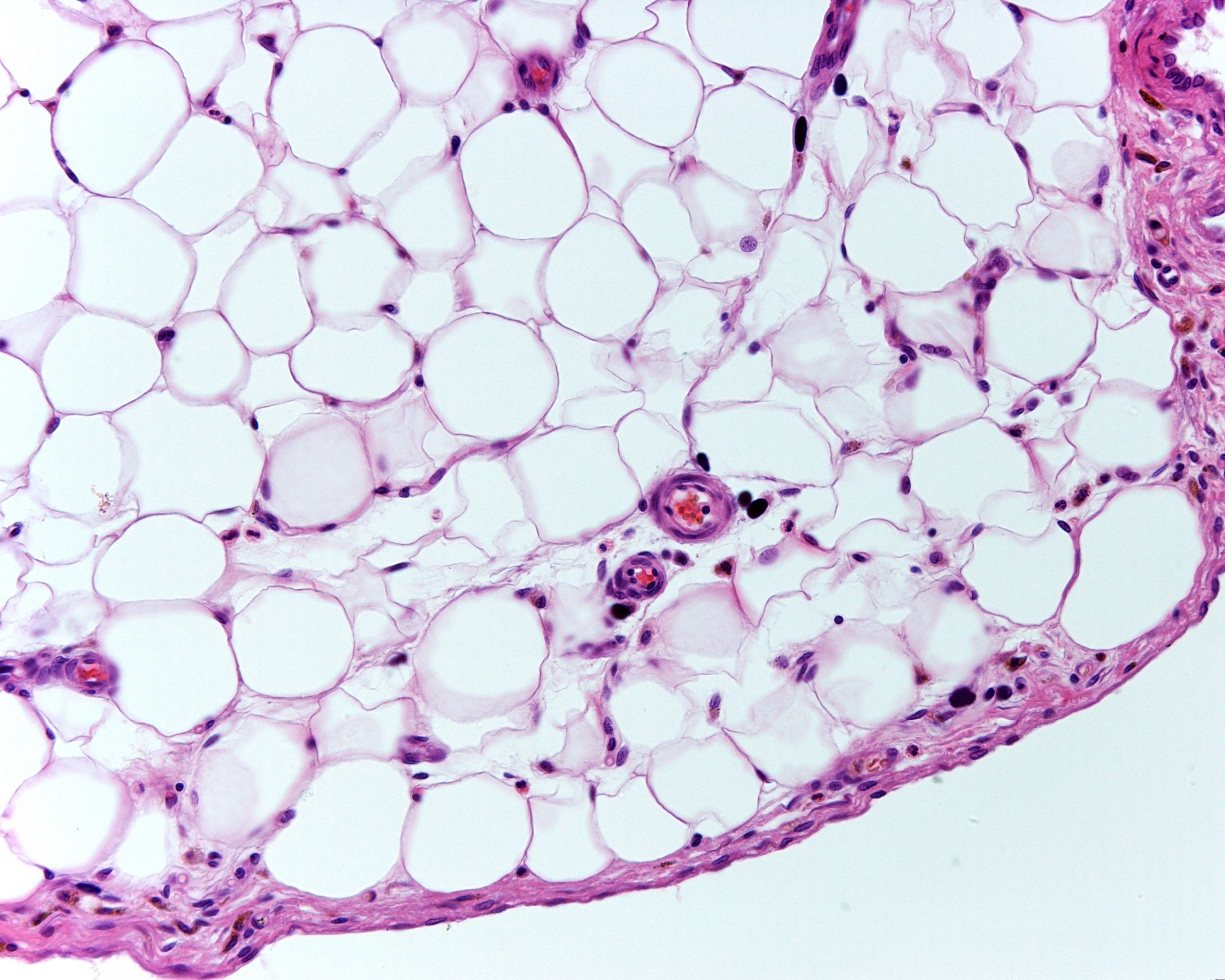 White adipose tissue or fat, stained with hematoxylin and eosin. Adipocytes (fat cells) contain a large lipid droplet.