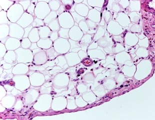 Turning Human Fat into Insulin-Producing Organoids That Reverse Diabetes