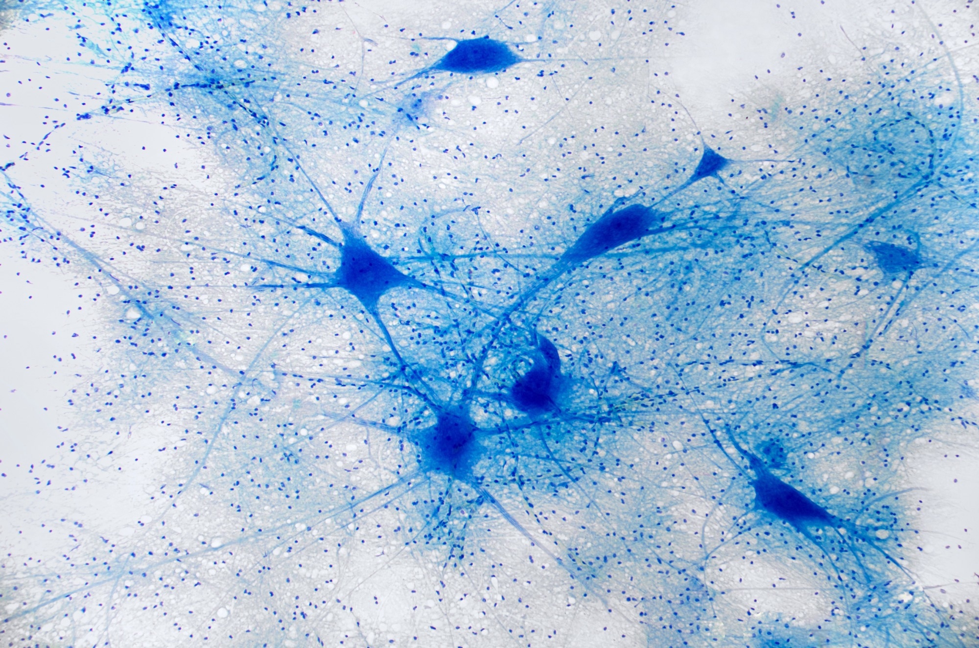 Photo of neurons under microscope view. Blue stain