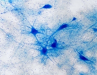 Why the Brain Never Stops Trying to Replace Myelin-Producing Cells