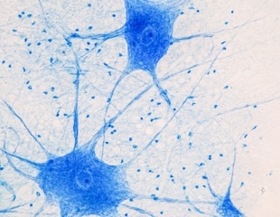 Lab-Grown Brain Tissue Masters a Classic Computing Benchmark