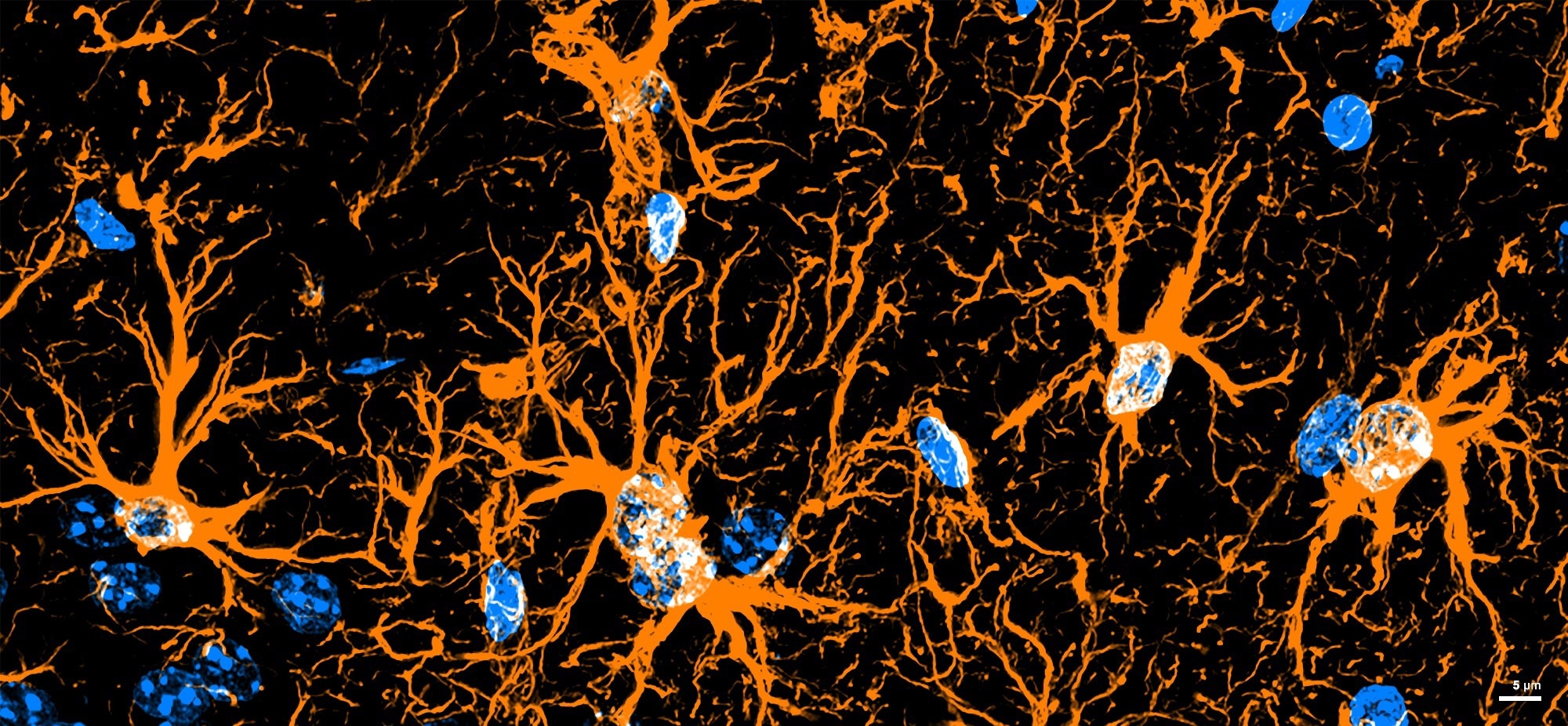 Fluorescence image of astrocytes and nuclei in the mouse hippocampus (magnified view)