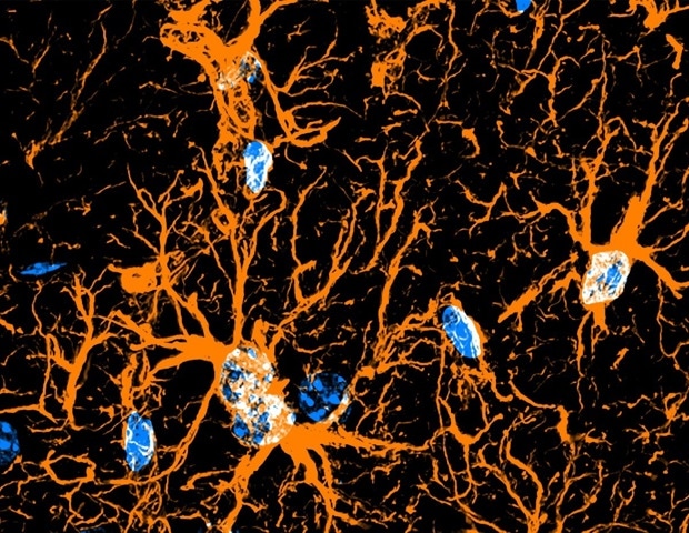 Unlocking the Fear Circuitry of the Brain