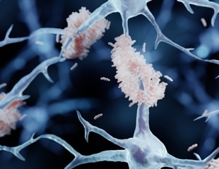 DNA Changes in Alzheimer’s That May Drive Disease Progression