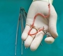 Regenerative Vascular Grafts Solve Key Shortage In Surgery