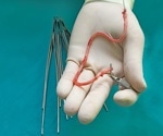 Regenerative Vascular Grafts Solve Key Shortage In Surgery