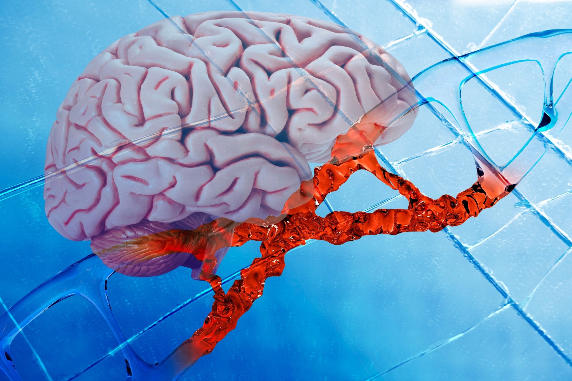 human brain on DNA helix background, deoxyribonucleic acid, brain disorder, human genome research method, development science, Brain Injury and Rehabilitation