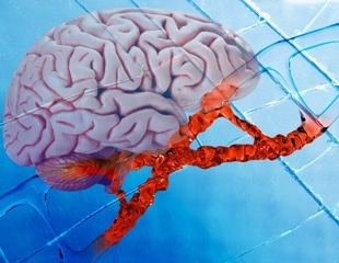 RNU2-2 Variants Drive Most Common Recessive Neurodevelopmental Disorder