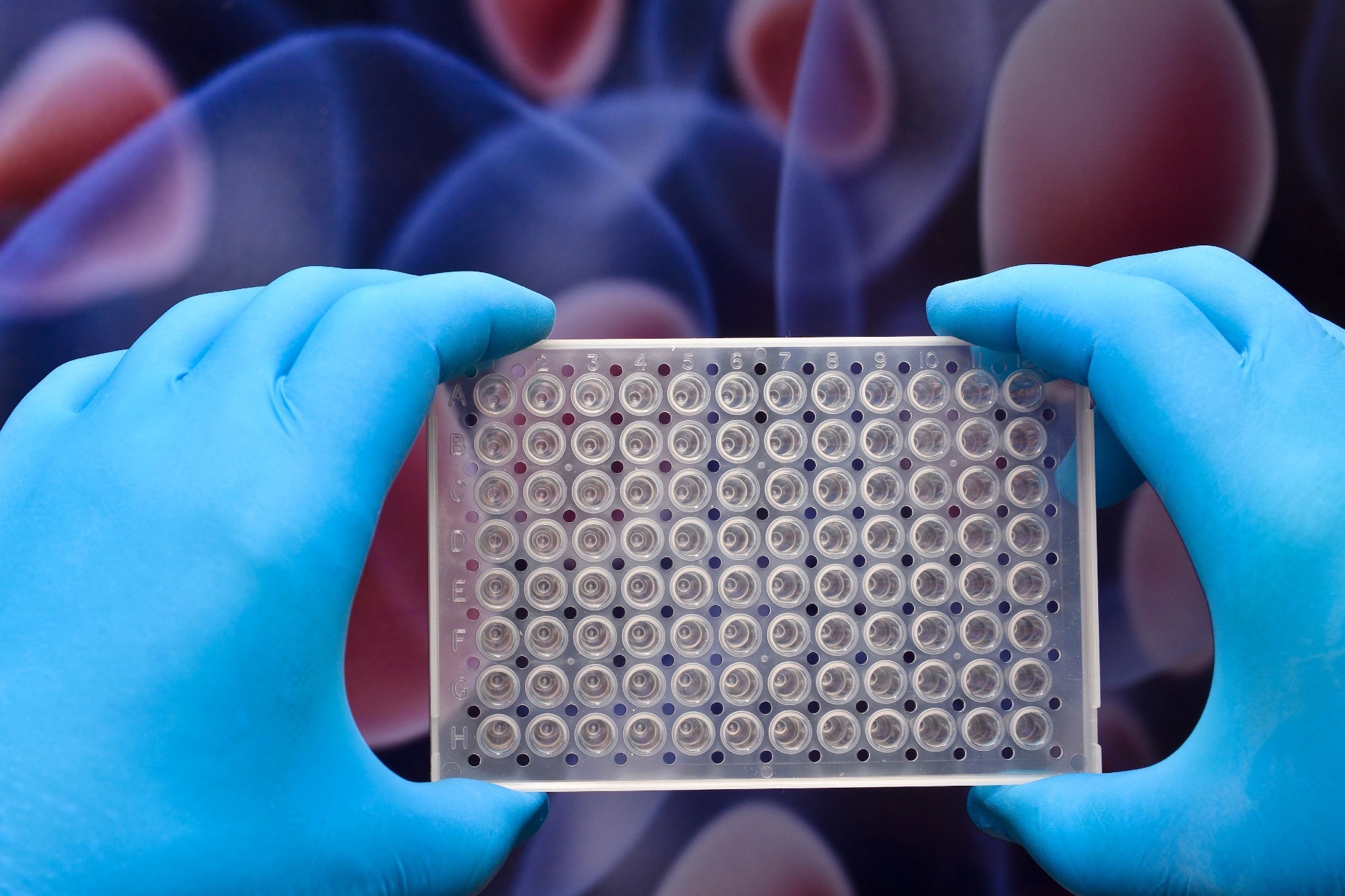 Multiwell plate. Image Credit: Sergei Drozd