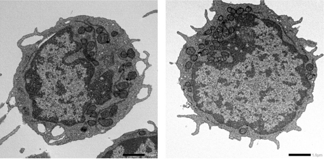 Non-Lethal Necroptosis Signaling Acts as a Regulator of Hematopoietic Aging