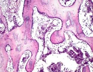 How Mitochondrial Damage Accelerates Stem Cell Aging