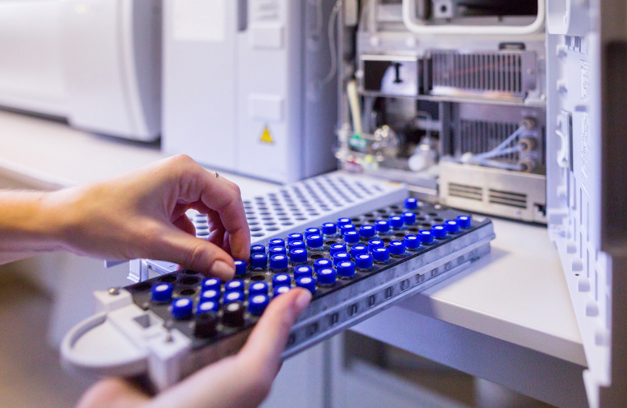 Study: What Does Next-Generation Mass Spectrometry Offer for Proteomics? A Comprehensive Platform Comparison. Image Credit: Sodel Vladyslav / Shutterstock