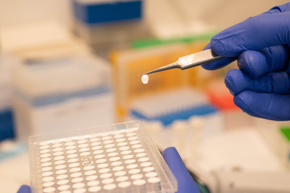 Study Reveals the "Black Box" of Protein Quality Control in the ER