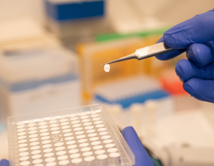 Study Reveals the "Black Box" of Protein Quality Control in the ER