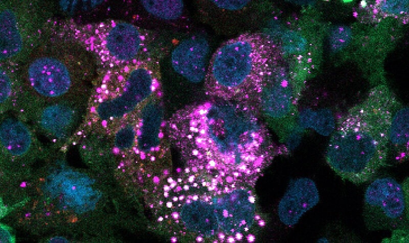 Uncovering a Second Pathway for On-Demand Glycogen Regulation