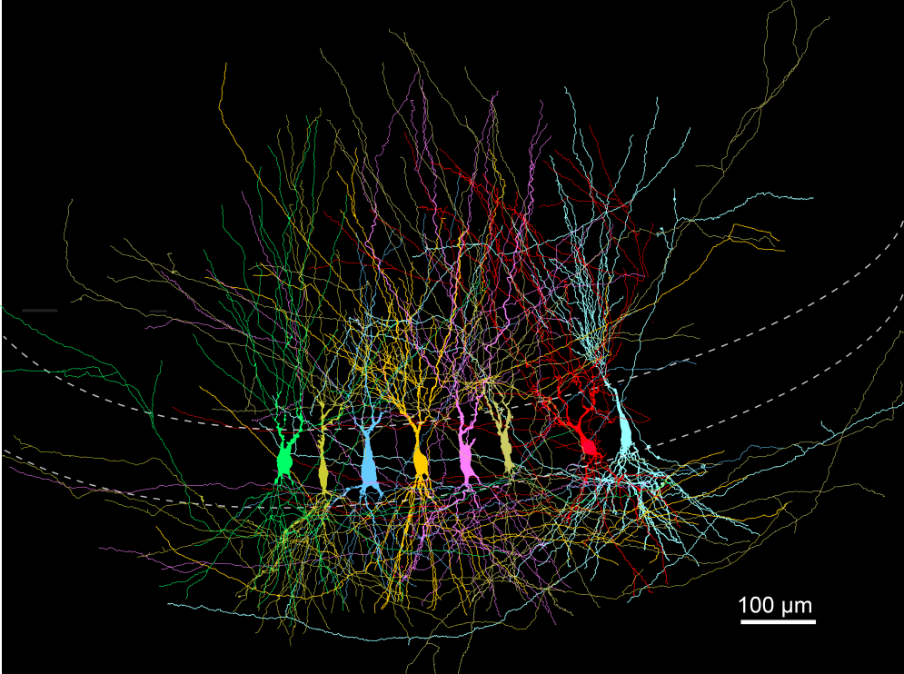 Dense Early Brain Networks Become Structured Through Developmental Pruning