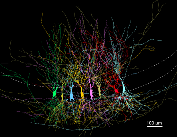 Dense Early Brain Networks Become Structured Through Developmental Pruning