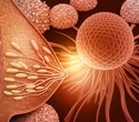 Intermediate PRRX1 Levels Drive Breast Cancer Metastasis Risk