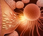 Intermediate PRRX1 Levels Drive Breast Cancer Metastasis Risk