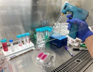 Hackensack Meridian Center for Discovery and Innovation Enhances Skin Fibrosis Research with Efficient Serological Pipet Controller