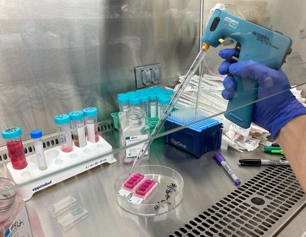 Hackensack Meridian Center for Discovery and Innovation Enhances Skin Fibrosis Research with Efficient Serological Pipet Controller