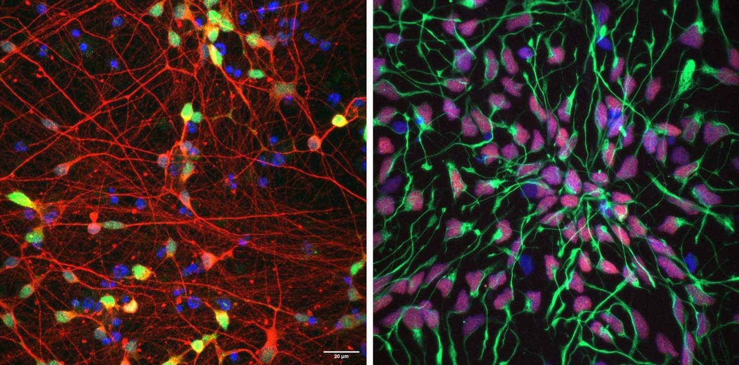Interactions Across the Genome Drive Neurodevelopmental Risks