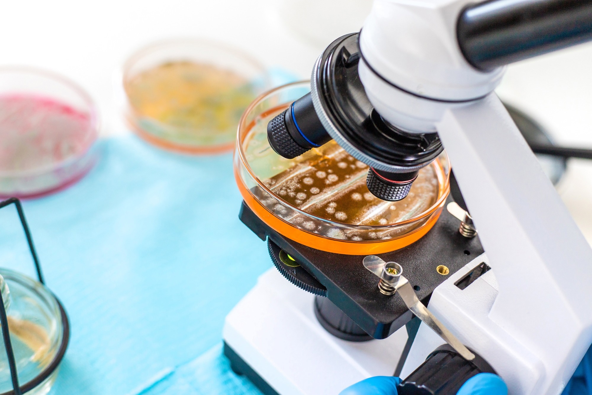 Examine bacteria in petri dishes in the laboratory.
