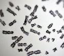 Why Women Face a Much Higher Risk of Autoimmune Disease