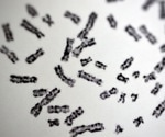Why Women Face a Much Higher Risk of Autoimmune Disease
