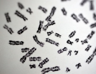 Why Women Face a Much Higher Risk of Autoimmune Disease