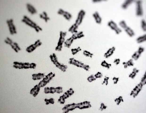Why Women Face a Much Higher Risk of Autoimmune Disease