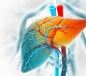 New 3D Human Liver Model Mimics Chronic Disease For 30 Days